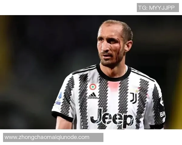 卡尔达拉深感遗憾未听基耶利尼劝告选择留在尤文图斯发展